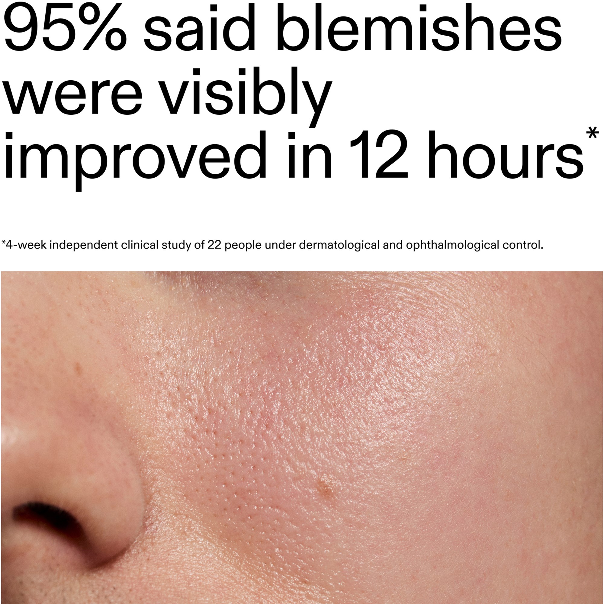 The Inkey List Succinic Acid Treatment 15 ml (obrázok 8)