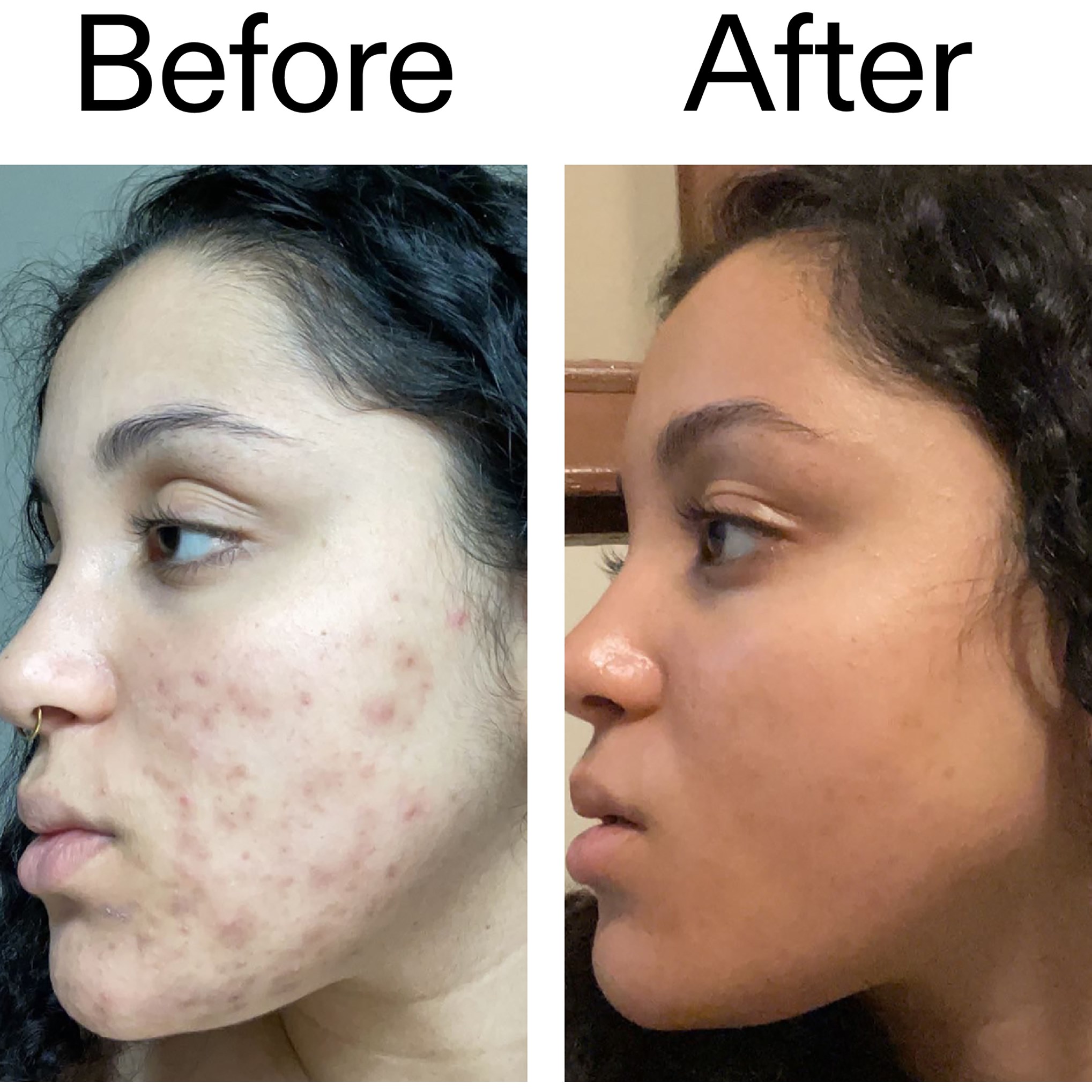 The Inkey List Tranexamic Acid Serum 30 ml (obrázok 8)