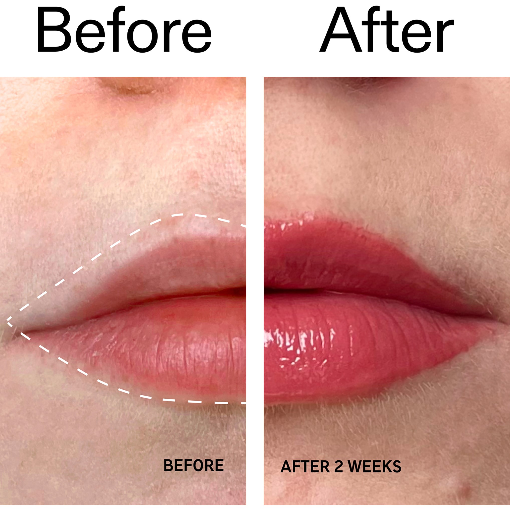 The Inkey List Tripeptide Plumping Lip Balm (obrázok 10)