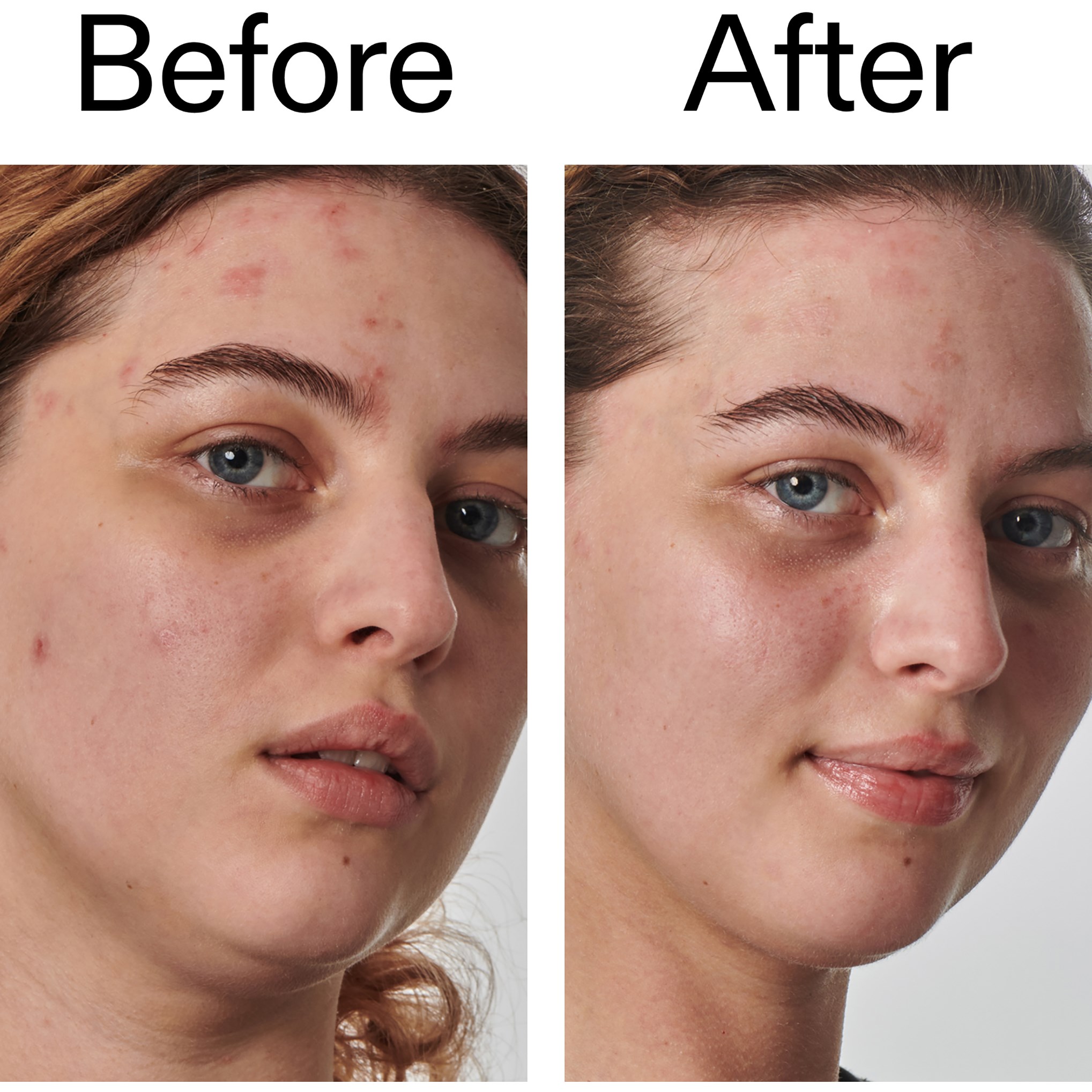 The Inkey List Urea 10% Moisturizer 50 ml (obrázok 10)