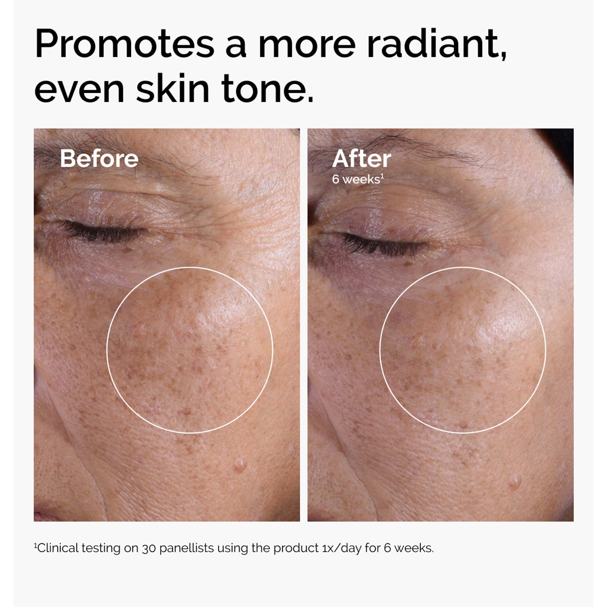 The Ordinary Glycolic Acid 7% Exfoliating Toner - tonik z kwasem gli (obrázok 3)