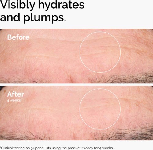 The Ordinary Hyaluronic Acid 2% + B5 120 ml