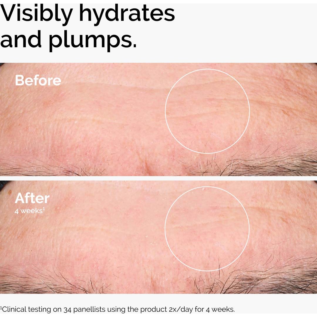 The Ordinary Hyaluronic Acid 2% + B5 120 ml (obrázok 3)