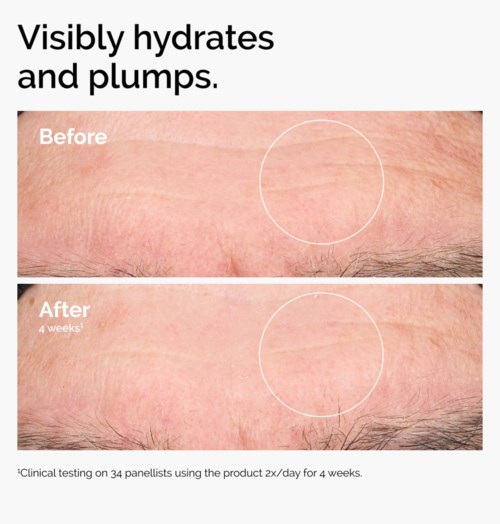 The Ordinary Hyaluronic Acid 2% + B5 30 ml