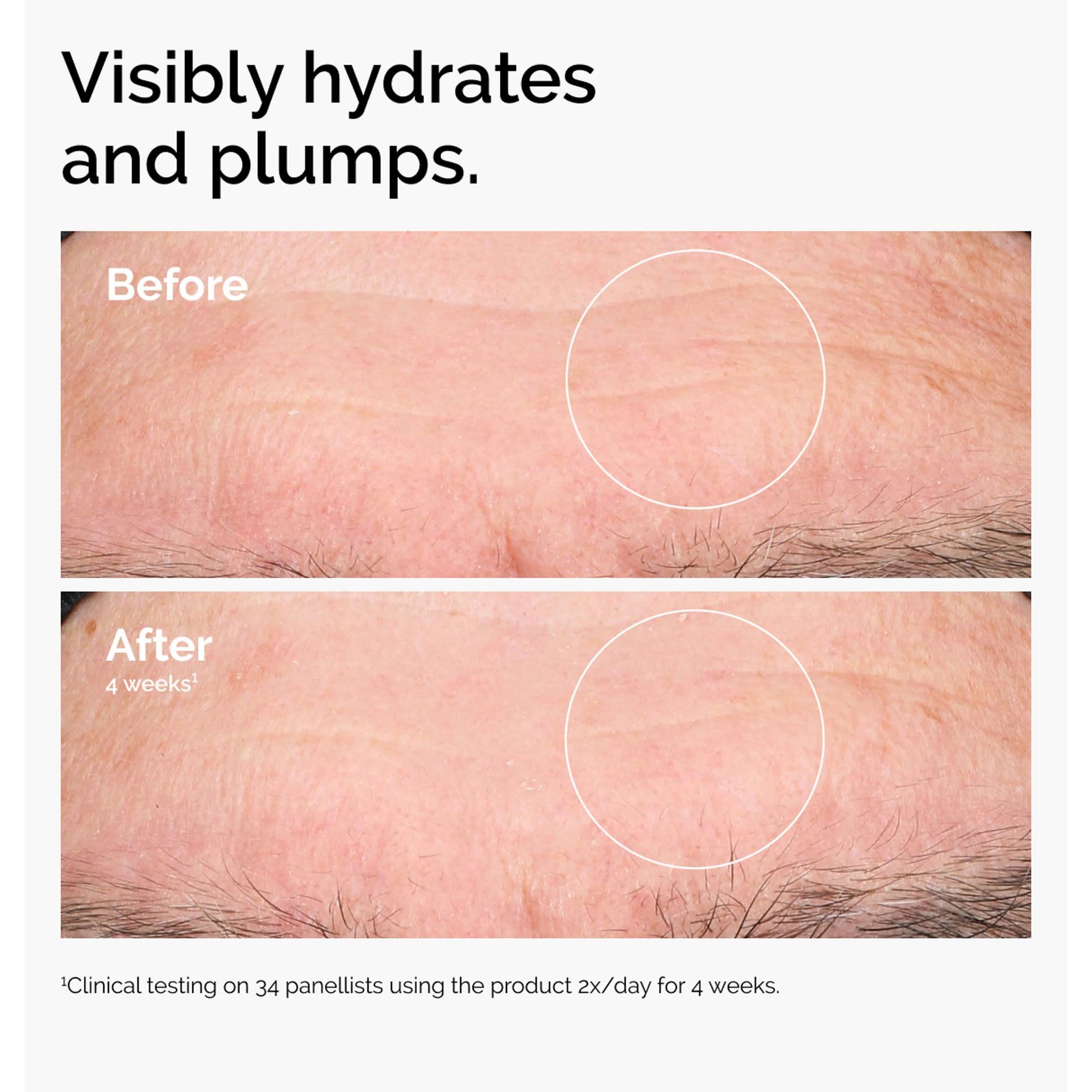 The Ordinary Hyaluronic Acid 2% + B5 30 ml (obrázok 3)