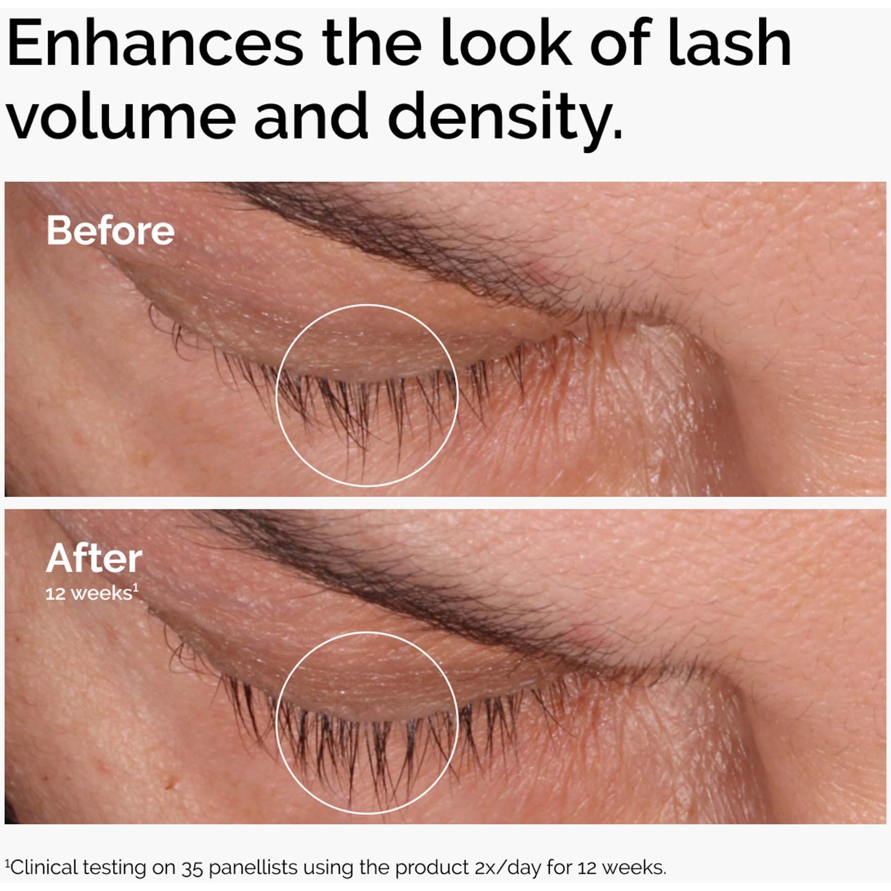 The Ordinary Multi-Peptide Lash and Brow Serum 5 ml (obrázok 3)