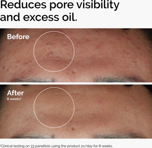 The Ordinary Niacinamide 10% + Zinc 1% 120 ml