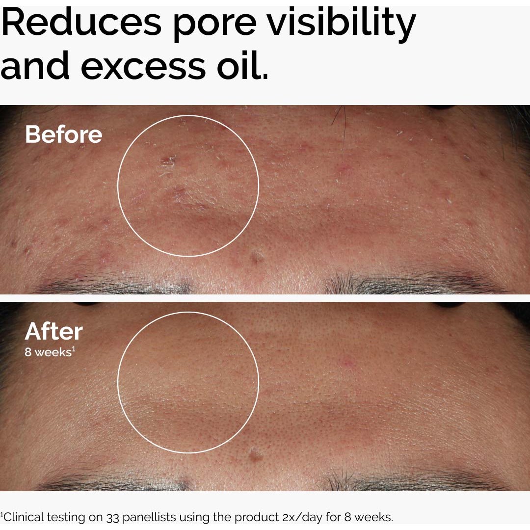 The Ordinary Niacinamide 10% + Zinc 1% 120 ml (obrázok 3)