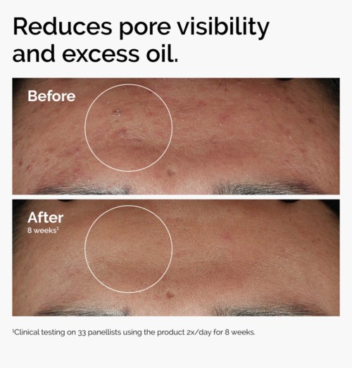 The Ordinary Niacinamide 10% + Zinc 1% 30 ml