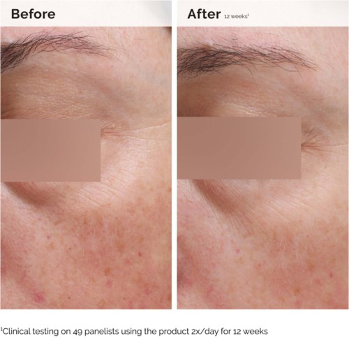 The Ordinary Niacinamide 5% Face & Body Emulsion 100 ml