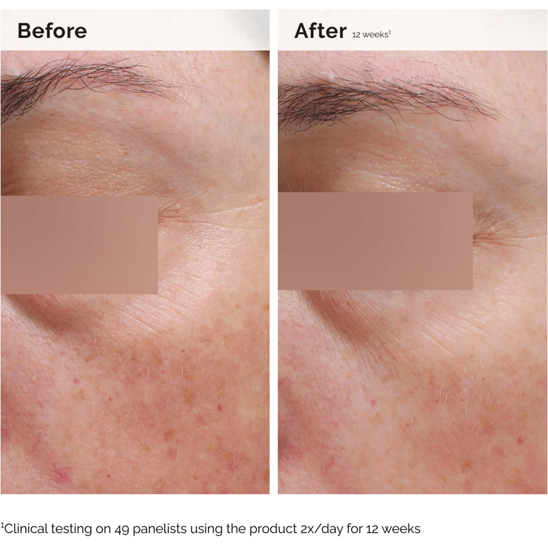 The Ordinary Niacinamide 5% Face & Body Emulsion 100 ml (obrázok 3)