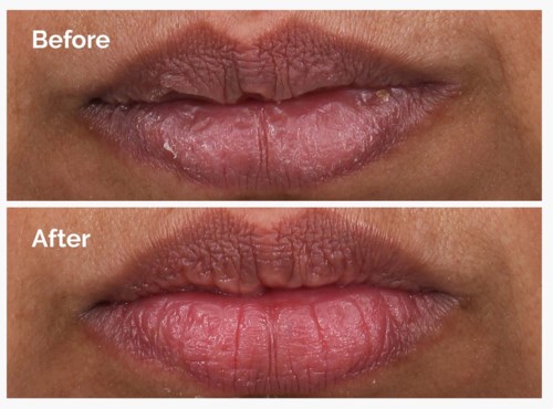 The Ordinary PHA 5% Exfoliating Lip Serum 15 ml
