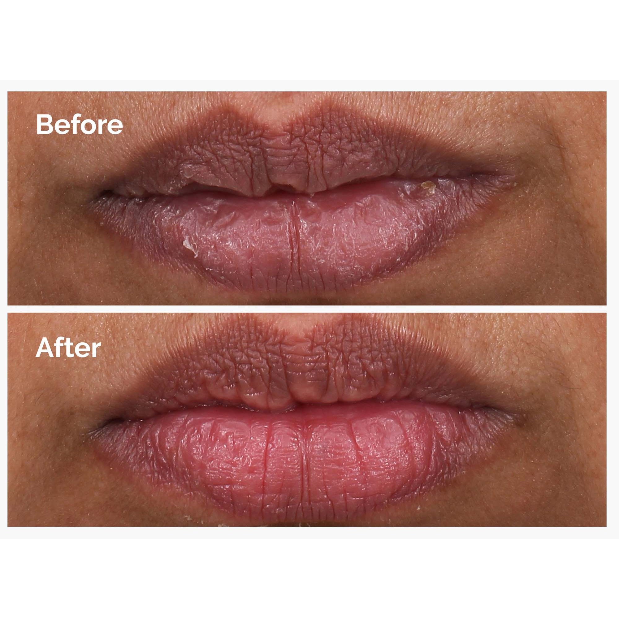 The Ordinary PHA 5% Exfoliating Lip Serum 15 ml (obrázok 3)