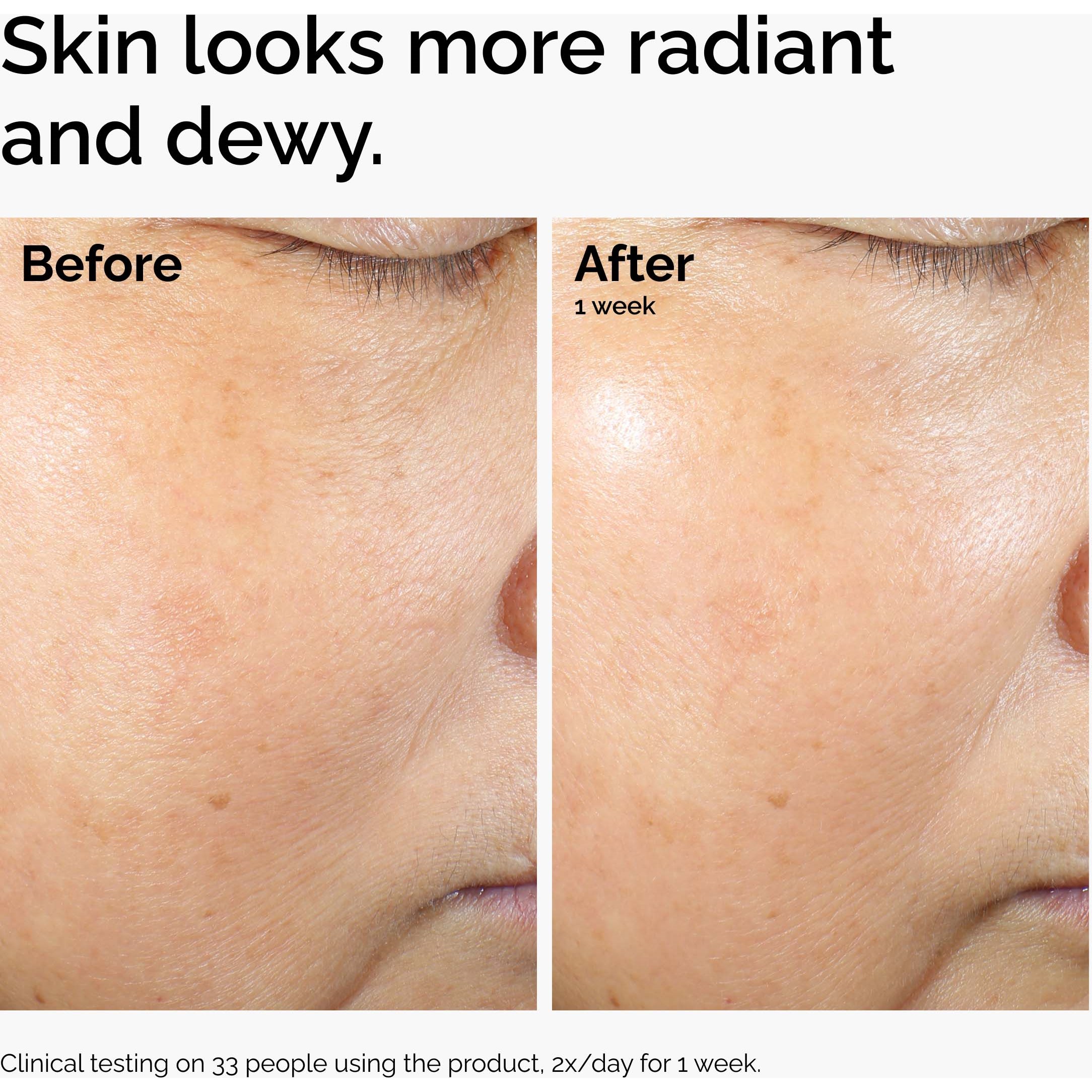 The Ordinary Rice Lipids + Ectoin Microemulsion 120 ml (obrázok 3)