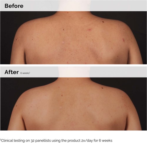The Ordinary Salicylic Acid 0.5% Body Serum 240 ml
