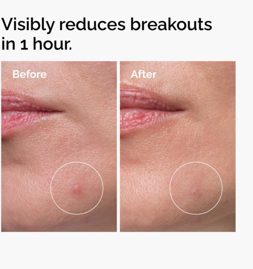 The Ordinary Sulfur 10% Powder-to-Cream Concentrate 5 g