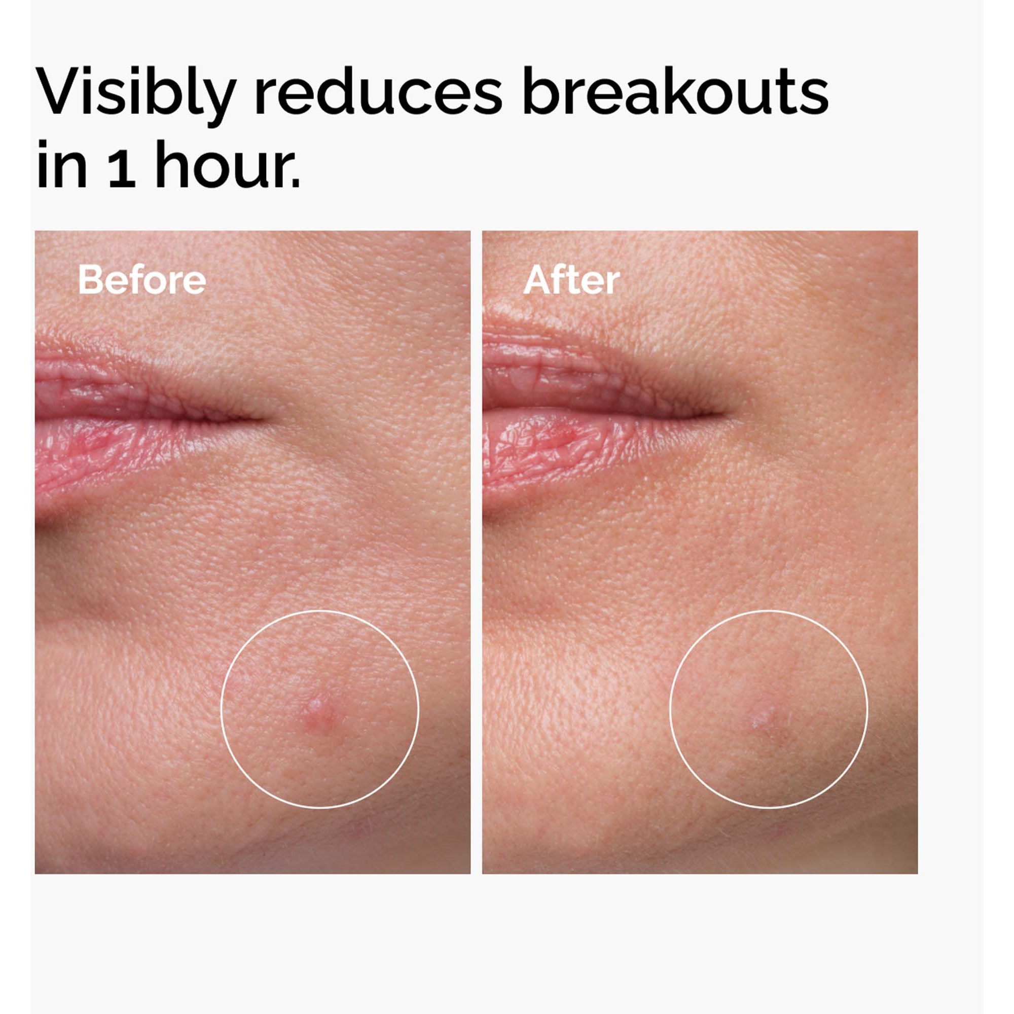 The Ordinary Sulfur 10% Powder-to-Cream Concentrate 5 g (obrázok 3)