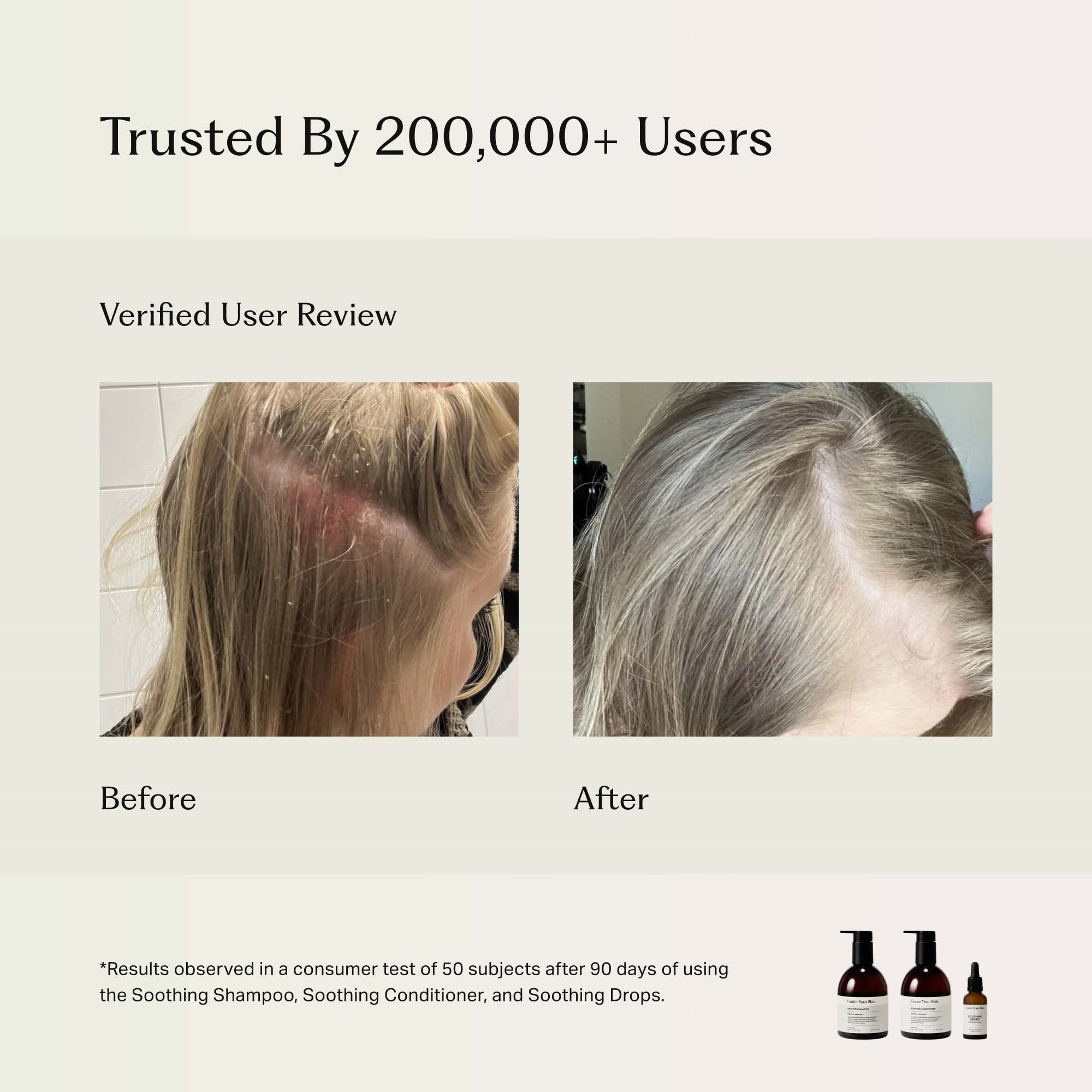 Under Your Skin Soothing Drops Soothes Dry Scalp 30 ml (obrázok 4)