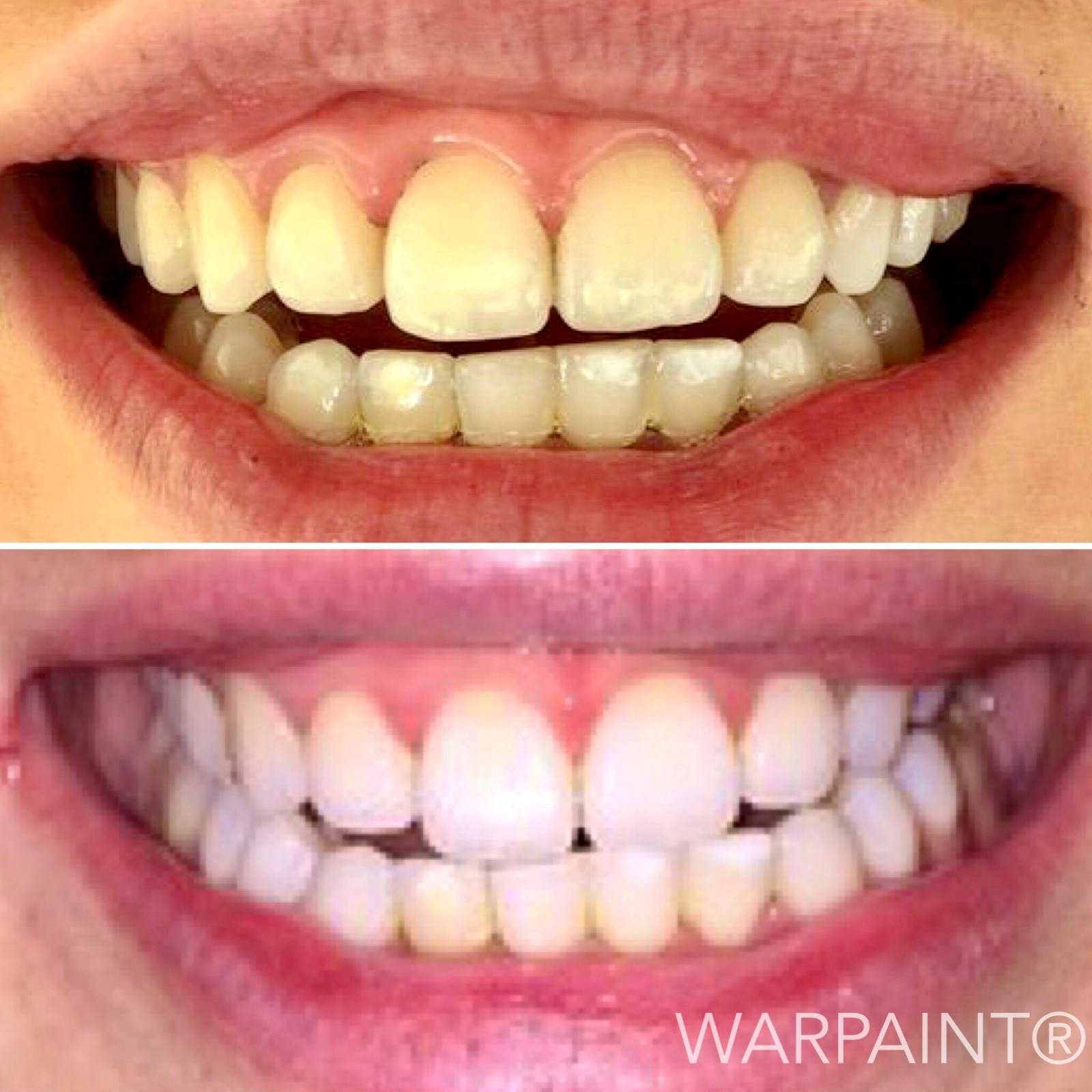 Warpaint Tandblekning 30 g (obrázok 5)