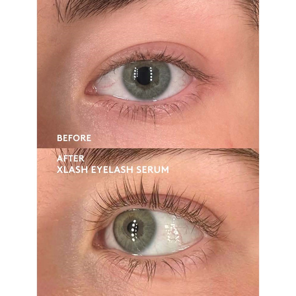 Xlash Eyelash Serum 5 ml (zdjęcie 5)