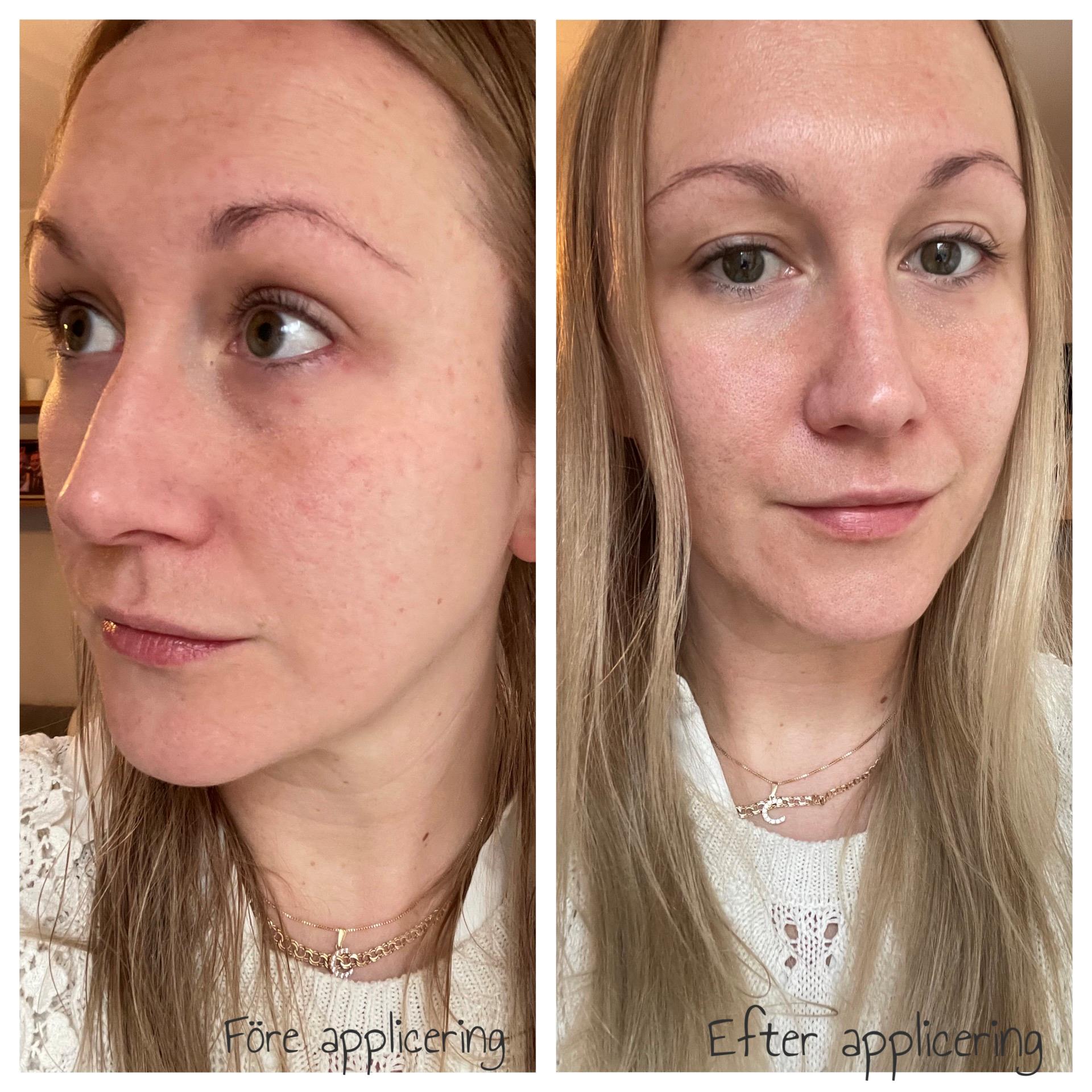 Bioeffect Egf Serum 15 ml | lyko.com