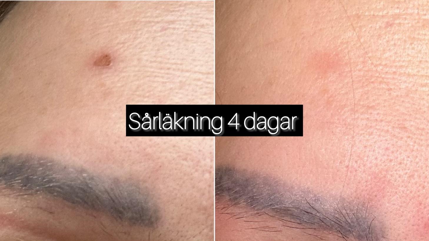 Silk'n LED Face Mask 100 | lyko.com