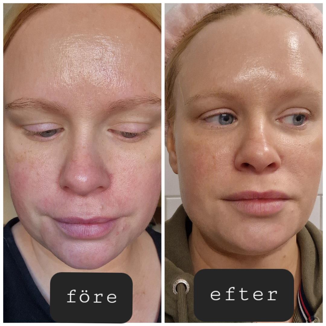 La Roche-Posay Toleriane Rosaliac AR Concentrate 40 ml | lyko.com