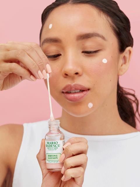 En kvinna med vita fläckar i ansiktet applicerar lotion från en flaska med en pipette.