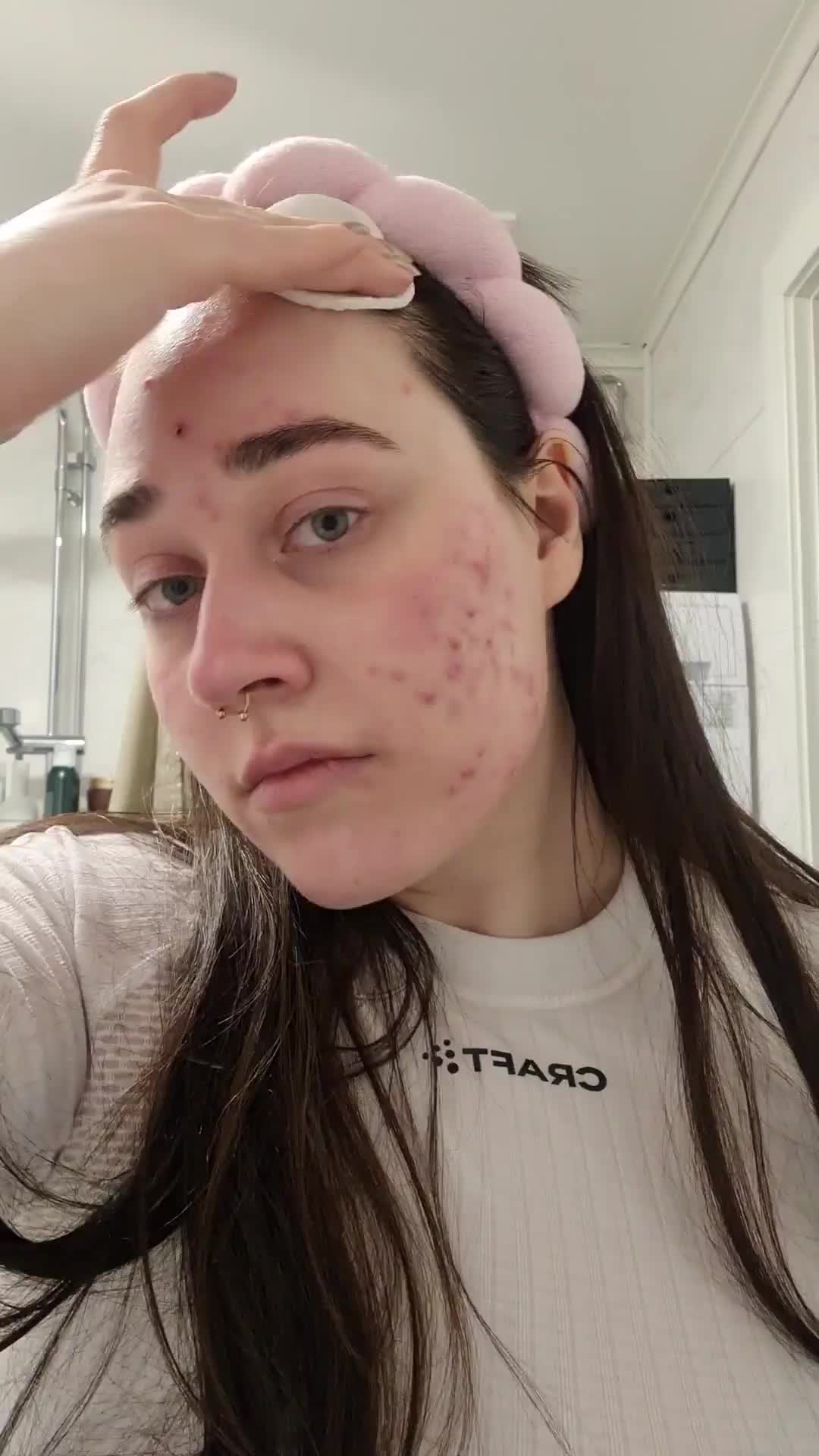Användarvideo